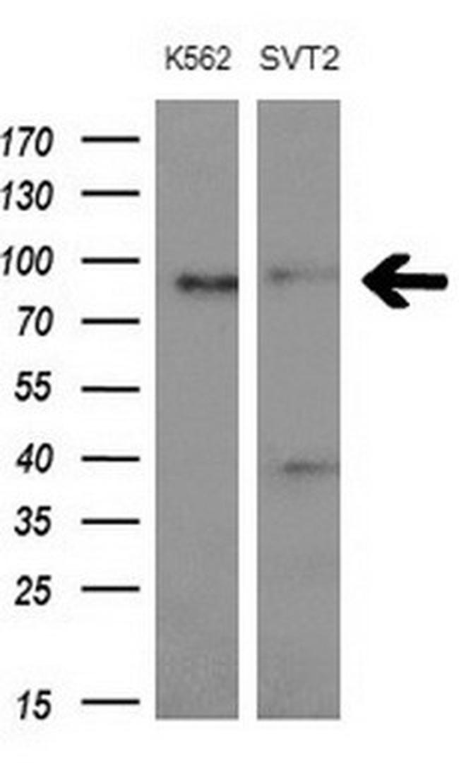 MARK3 Antibody in Western Blot (WB)