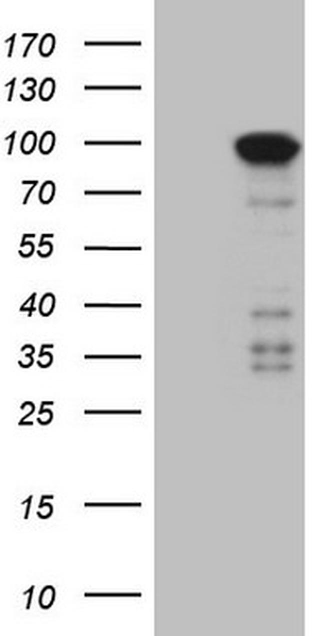 MARK3 Antibody in Western Blot (WB)