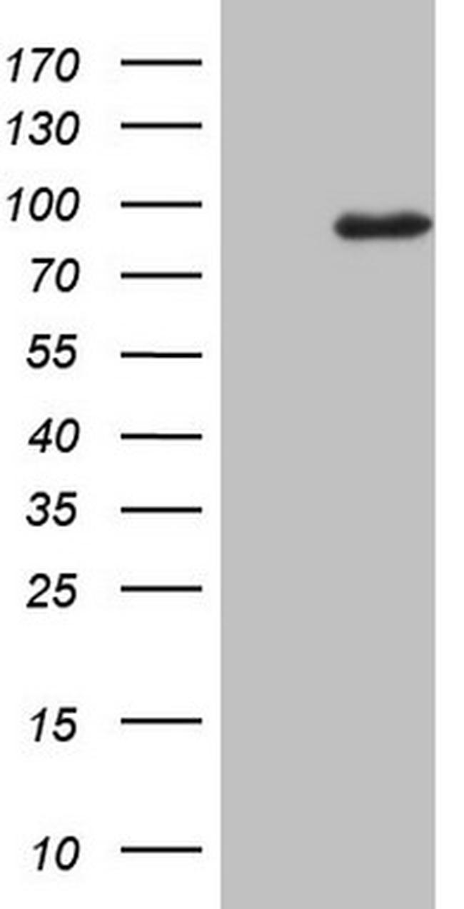 MARK3 Antibody in Western Blot (WB)