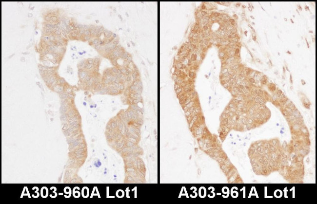 MARS Antibody in Immunohistochemistry (IHC)