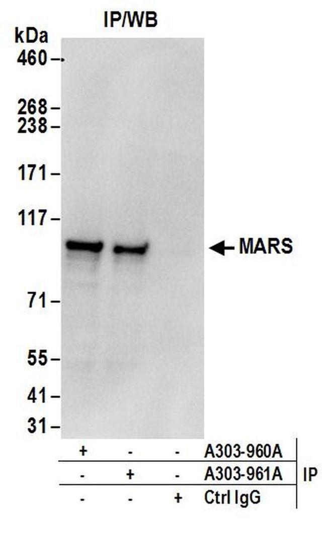 MARS Antibody in Western Blot (WB)