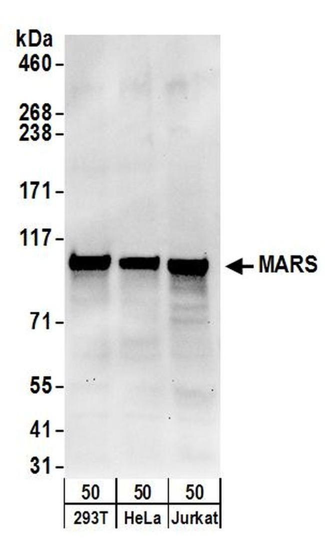 MARS Antibody in Western Blot (WB)