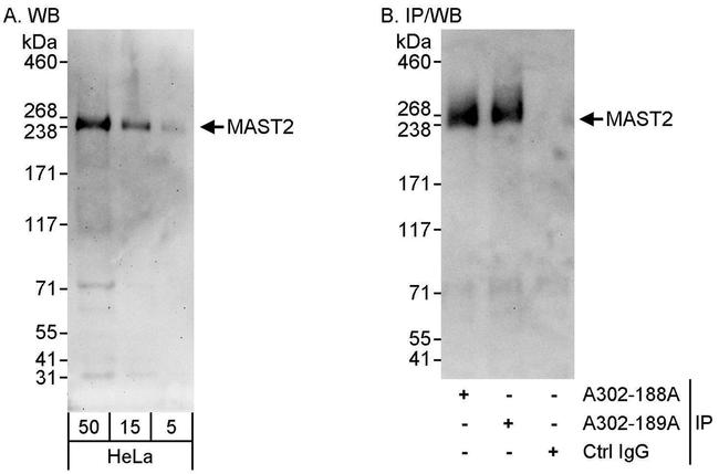 MAST2 Antibody in Western Blot (WB)