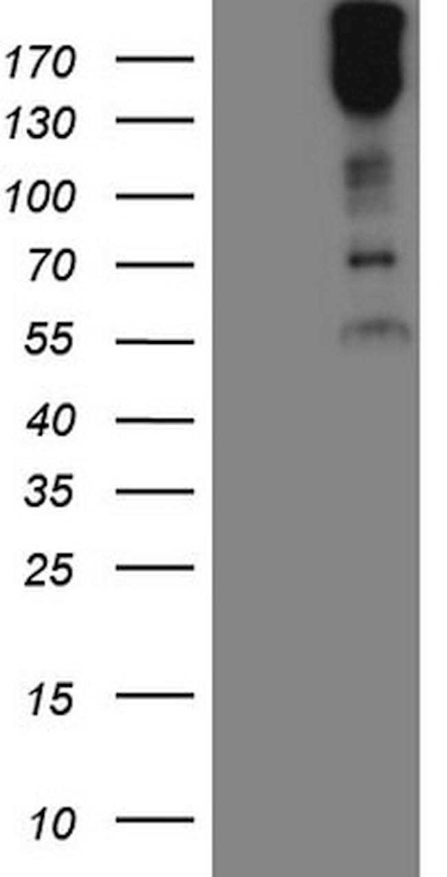 MAST2 Antibody in Western Blot (WB)