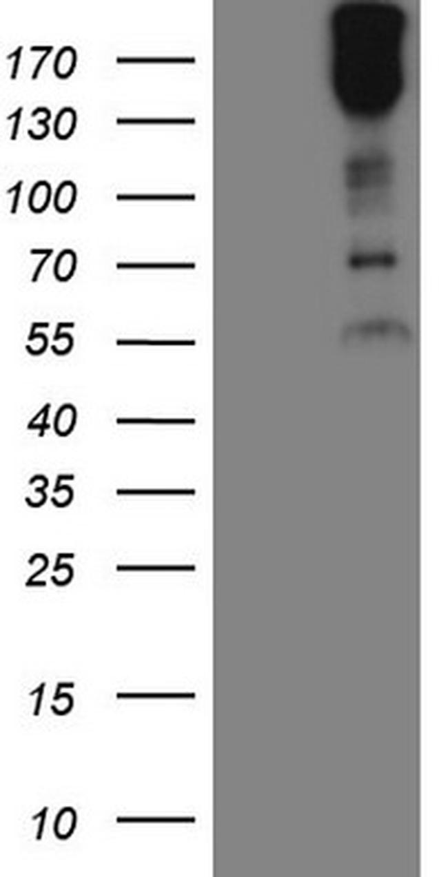 MAST2 Antibody in Western Blot (WB)