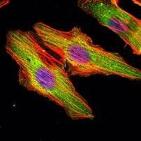 MATN1 Antibody in Immunocytochemistry (ICC/IF)