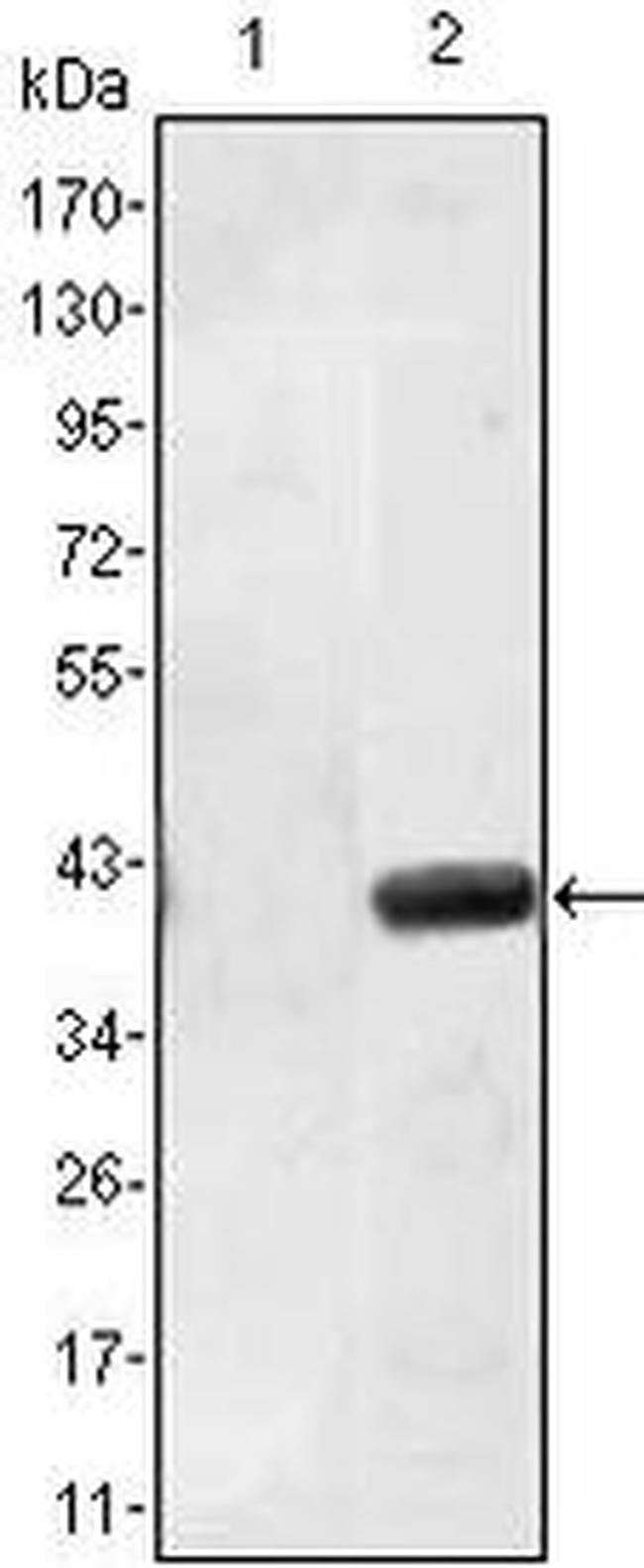 MATN1 Antibody in Western Blot (WB)