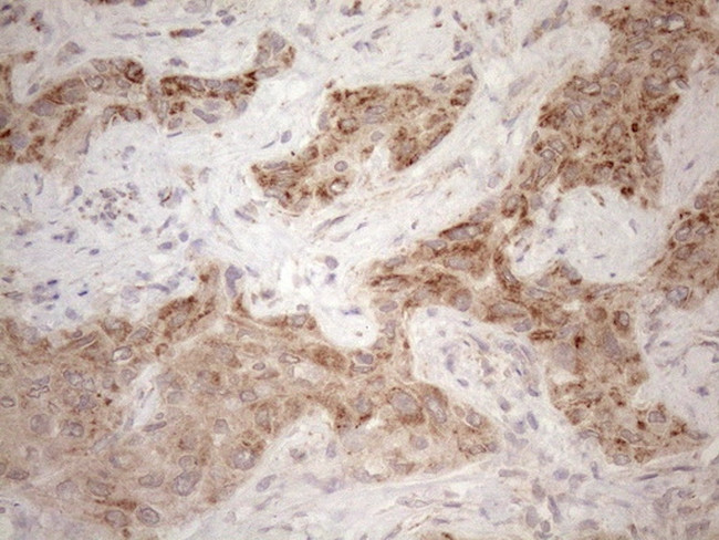 MAVS Antibody in Immunohistochemistry (Paraffin) (IHC (P))