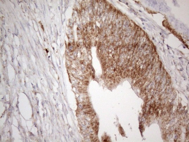 MAVS Antibody in Immunohistochemistry (Paraffin) (IHC (P))