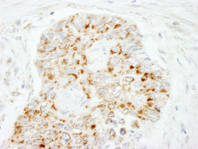 MAVS/VISA Antibody in Immunohistochemistry (IHC)