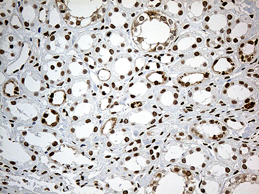 MBD1 Antibody in Immunohistochemistry (Paraffin) (IHC (P))