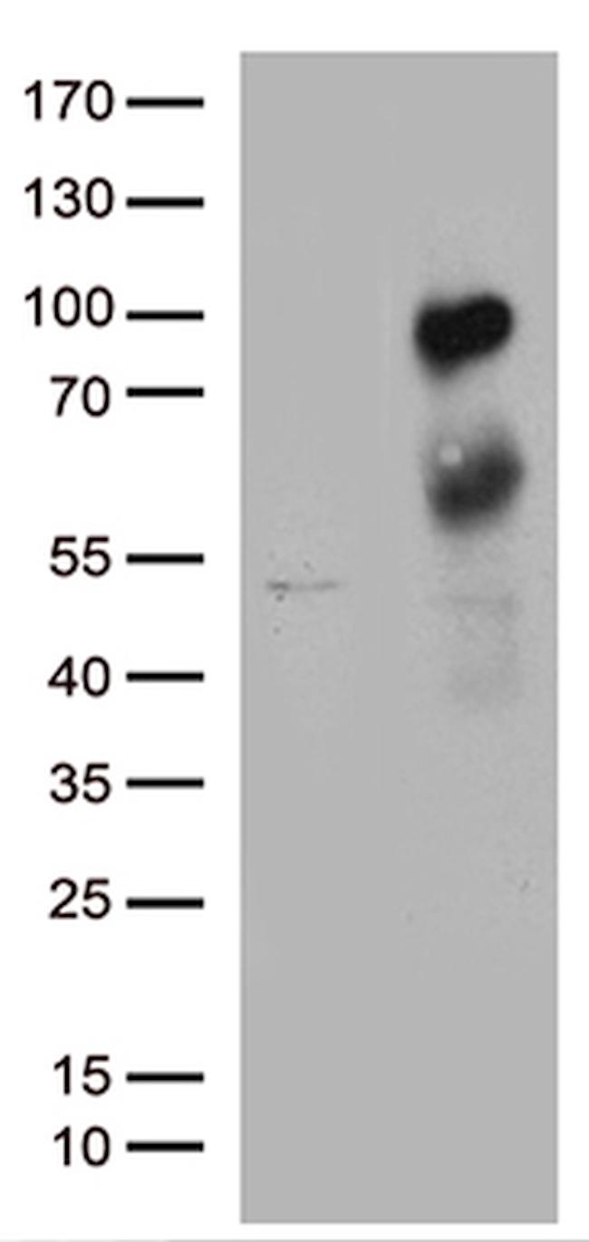 MBD1 Antibody in Western Blot (WB)