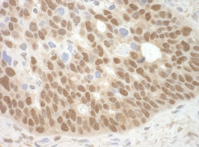 MBD3 Antibody in Immunohistochemistry (IHC)