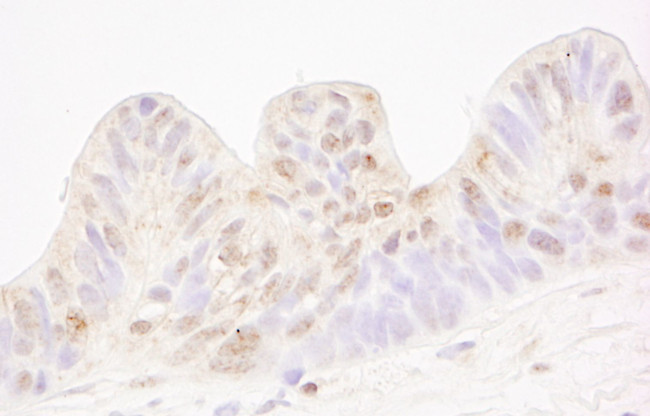 MBD4 Antibody in Immunohistochemistry (IHC)