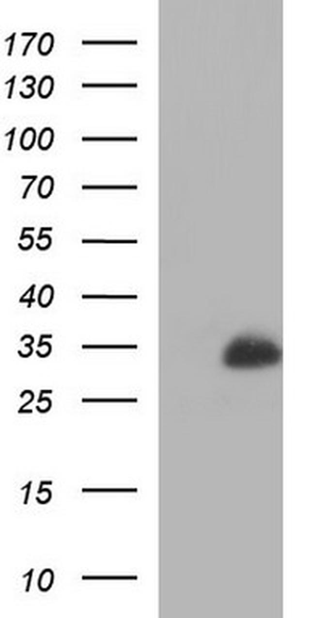 MBL2 Antibody in Western Blot (WB)