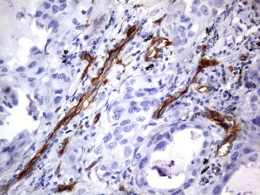 MCAM Antibody in Immunohistochemistry (Paraffin) (IHC (P))