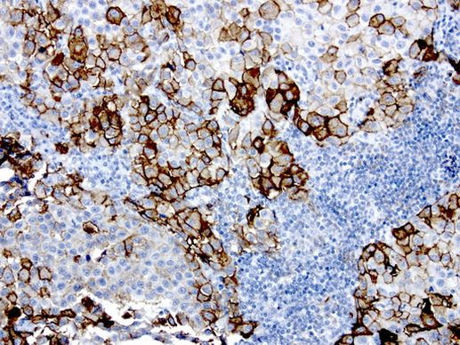 MCAM Antibody in Immunohistochemistry (Paraffin) (IHC (P))