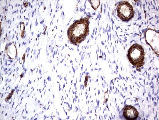 MCAM Antibody in Immunohistochemistry (Paraffin) (IHC (P))