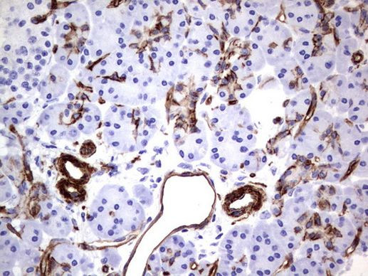 MCAM Antibody in Immunohistochemistry (Paraffin) (IHC (P))