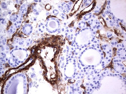 MCAM Antibody in Immunohistochemistry (Paraffin) (IHC (P))