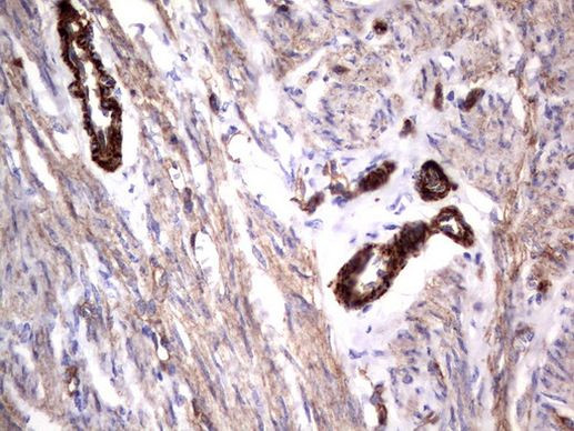 MCAM Antibody in Immunohistochemistry (Paraffin) (IHC (P))