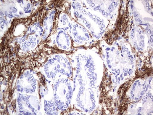 MCAM Antibody in Immunohistochemistry (Paraffin) (IHC (P))