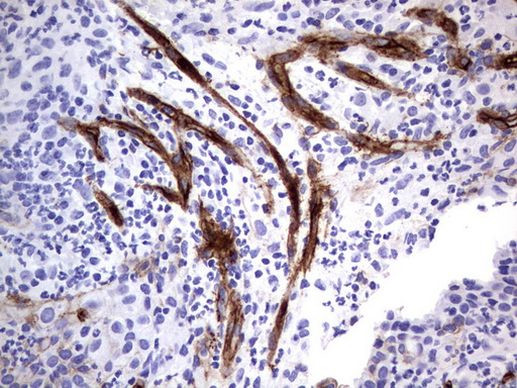 MCAM Antibody in Immunohistochemistry (Paraffin) (IHC (P))