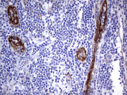 MCAM Antibody in Immunohistochemistry (Paraffin) (IHC (P))