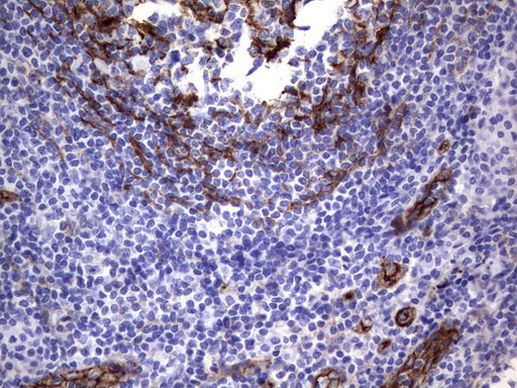 MCAM Antibody in Immunohistochemistry (Paraffin) (IHC (P))