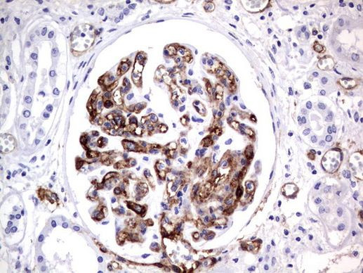 MCAM Antibody in Immunohistochemistry (Paraffin) (IHC (P))