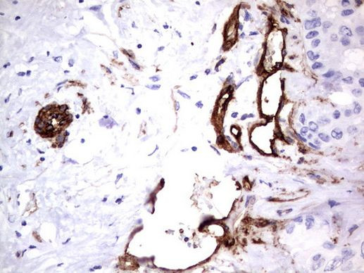 MCAM Antibody in Immunohistochemistry (Paraffin) (IHC (P))