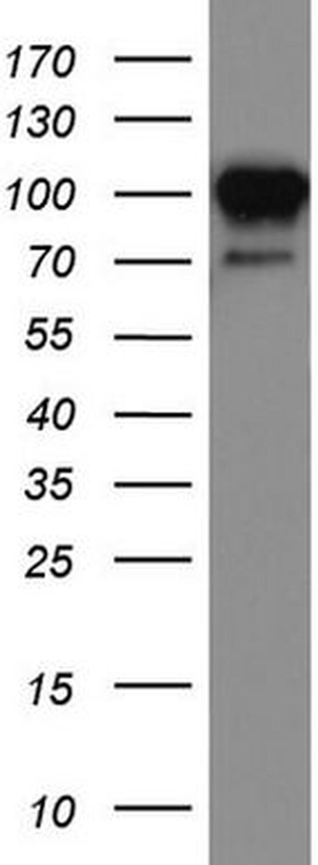 MCAM Antibody in Western Blot (WB)