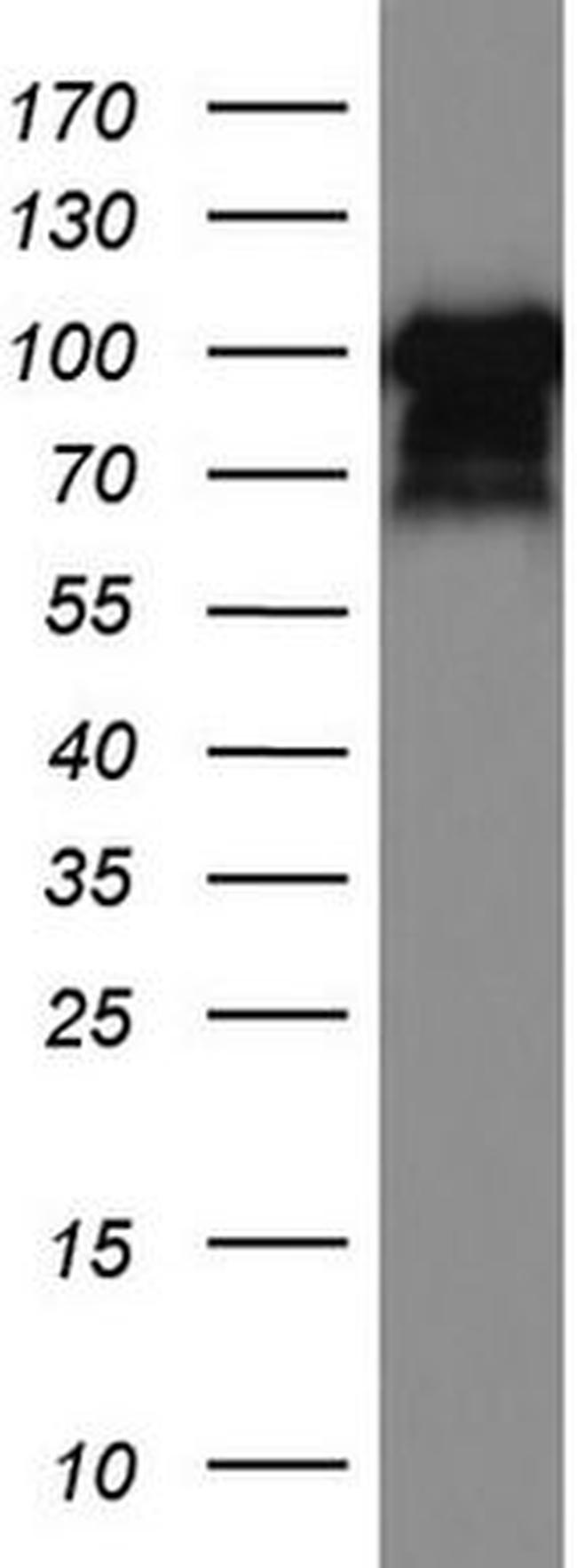 MCAM Antibody in Western Blot (WB)