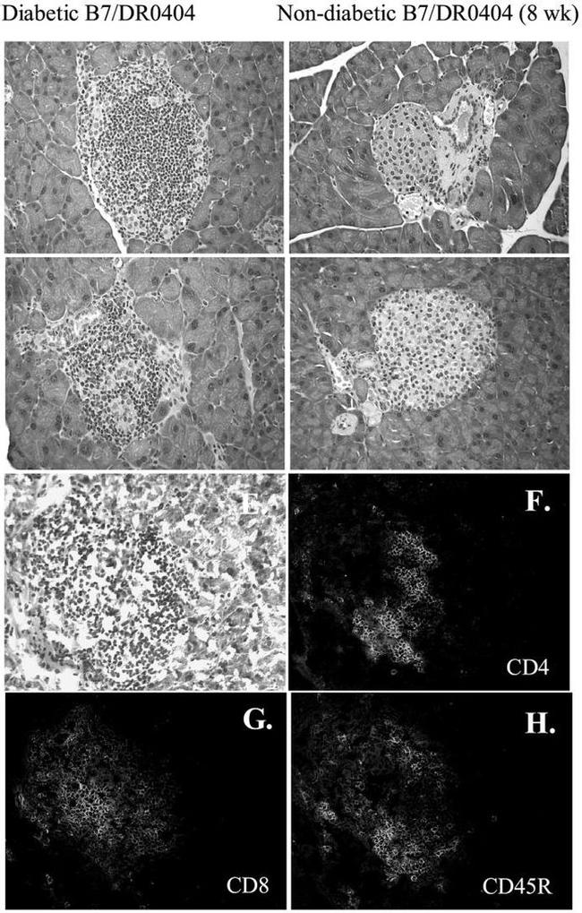 CD8 alpha Antibody in Immunohistochemistry (Frozen) (IHC (F))