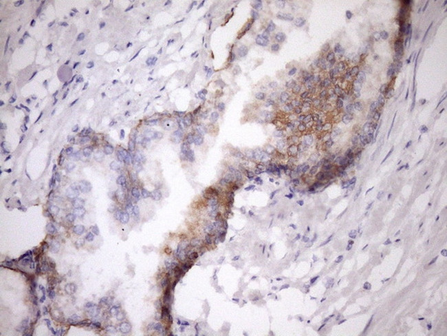 MCEE Antibody in Immunohistochemistry (Paraffin) (IHC (P))