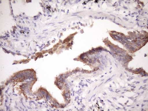 MCEE Antibody in Immunohistochemistry (Paraffin) (IHC (P))