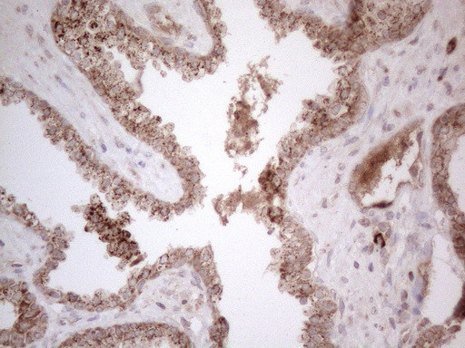 MCEE Antibody in Immunohistochemistry (Paraffin) (IHC (P))