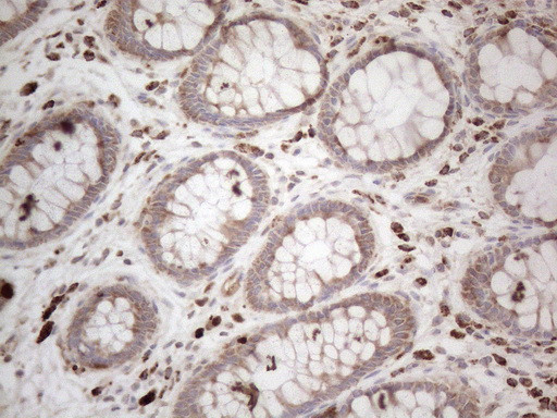 MCEE Antibody in Immunohistochemistry (Paraffin) (IHC (P))