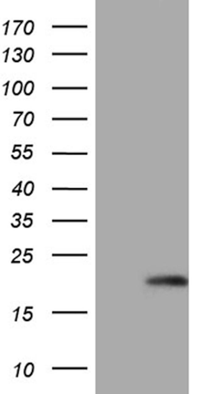 MCEE Antibody in Western Blot (WB)