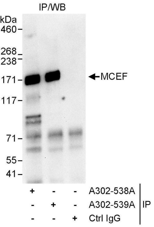 MCEF Antibody in Immunoprecipitation (IP)