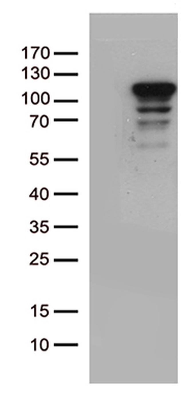 MCF2 Antibody in Western Blot (WB)