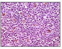 MCL-1 Antibody in Immunohistochemistry (Paraffin) (IHC (P))