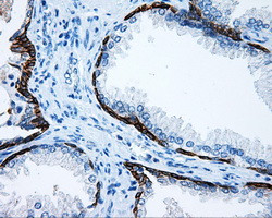 MCL1 Antibody in Immunohistochemistry (Paraffin) (IHC (P))