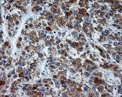 MCL1 Antibody in Immunohistochemistry (Paraffin) (IHC (P))