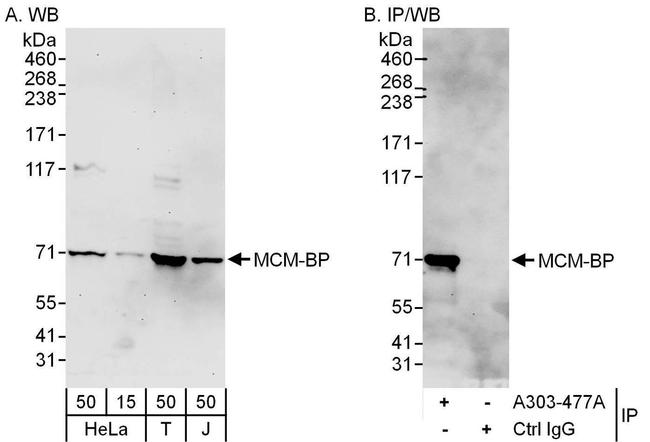 MCM-BP Antibody in Western Blot (WB)