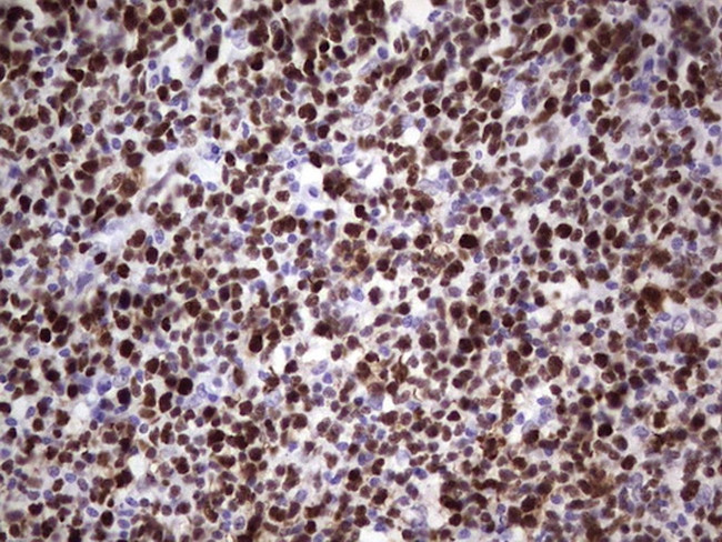 MCM2 Antibody in Immunohistochemistry (Paraffin) (IHC (P))