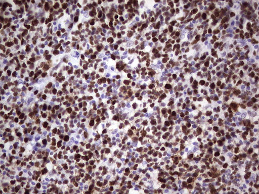 MCM2 Antibody in Immunohistochemistry (Paraffin) (IHC (P))