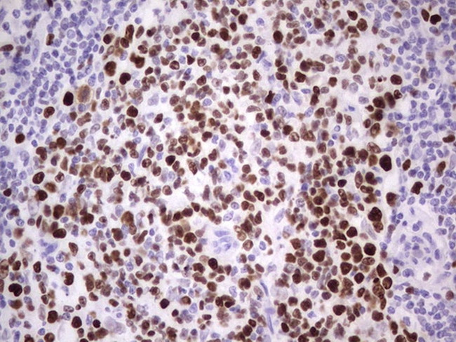 MCM2 Antibody in Immunohistochemistry (Paraffin) (IHC (P))