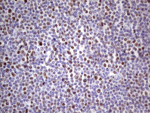 MCM2 Antibody in Immunohistochemistry (Paraffin) (IHC (P))