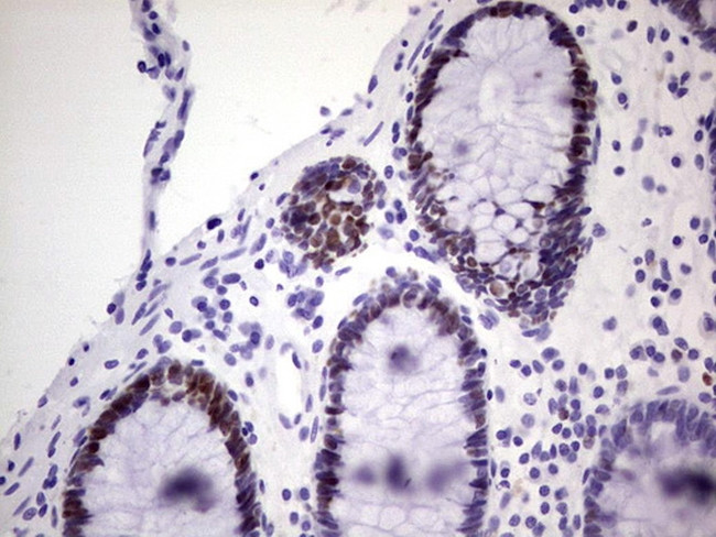 MCM2 Antibody in Immunohistochemistry (Paraffin) (IHC (P))